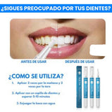 blanqueador dental PRODUCTO WINNER