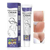 ELIMINADOR DE ESTRIAS